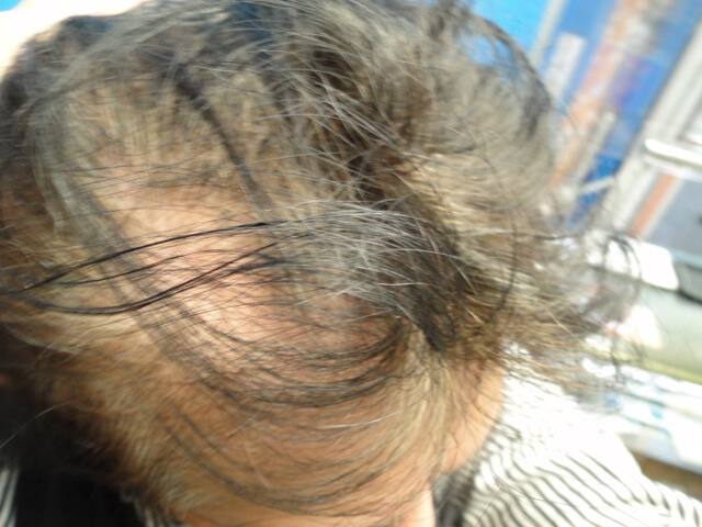 管理人シバの薄毛の状態