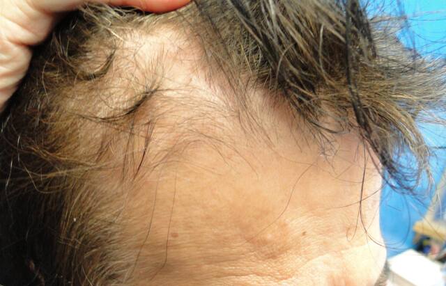 管理人シバの薄毛の状態